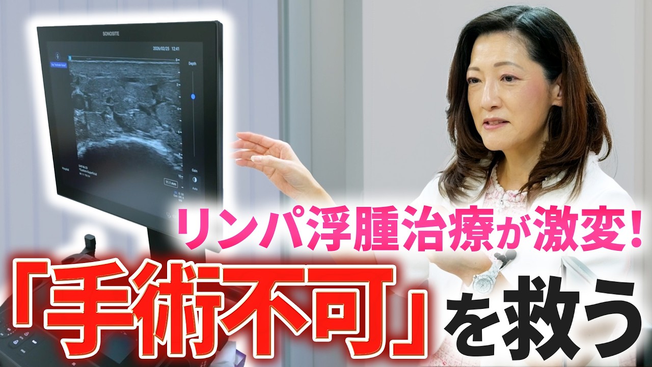 リンパ浮腫への活用は日本初！超高周波超音波画像診断装置「Sonosite