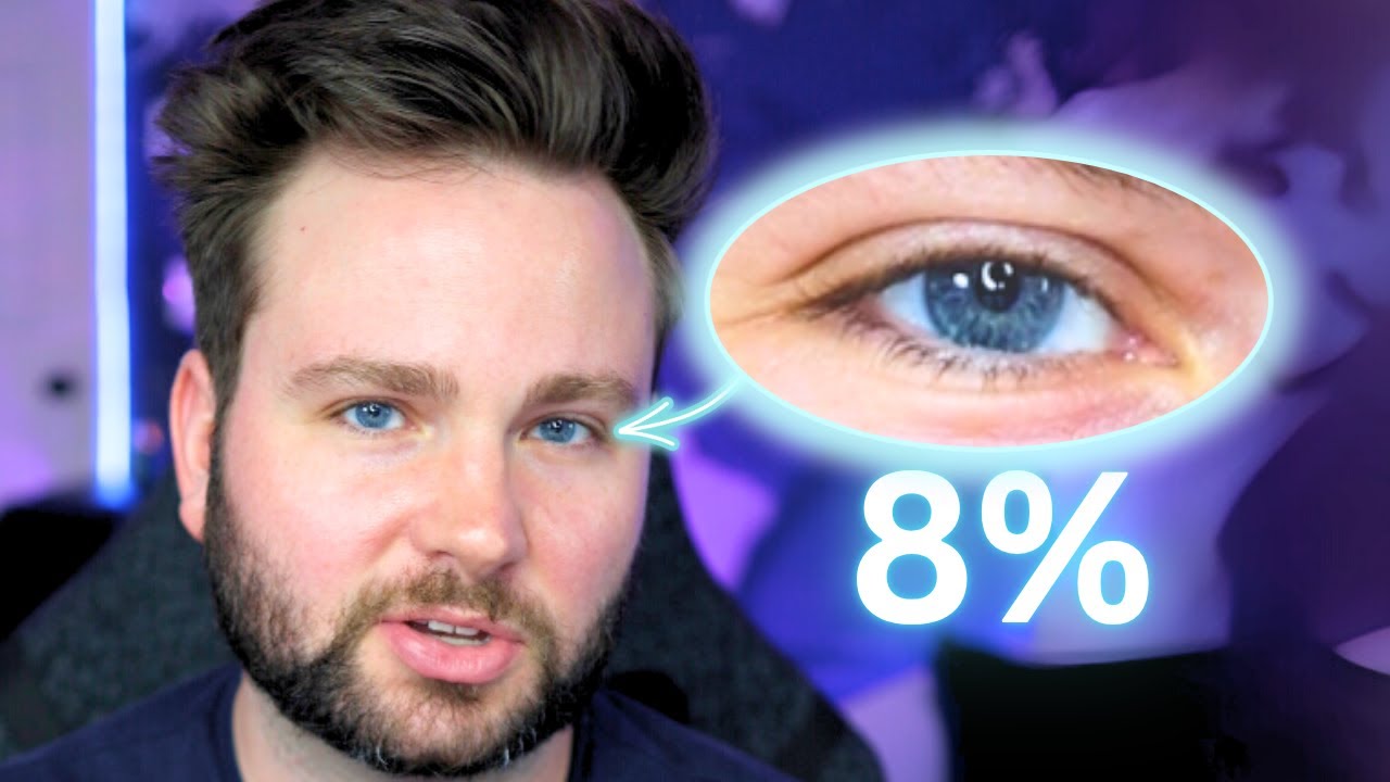 How Rare Is Your Body?