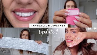 I GOT INVISALIGN! WHY? HOW LONG FOR? ATTACHMENTS? | INVISALIGN JOURNEY UPDATE 1 by Liza Prideaux 13,368 views 3 months ago 17 minutes