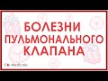 Болезни пульмонального клапана: стеноз и регургитация/недостаточность клапана.