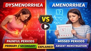 “Dysmenorrhea and Amenorrhea Explained 😱 | Causes, Symptoms &amp; Relief Tips”