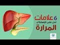 اعراض التهاب المرارة مع توضيح العلاج