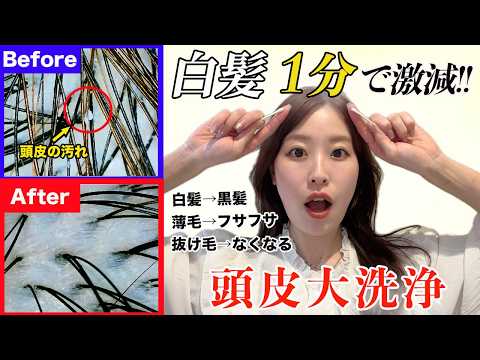 お風呂前の頭皮ケアで白髪がみるみる激減!薄毛,抜け毛や頭皮の嫌な臭いにも効果的な頭皮ケア♡