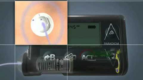 (EN) MiniMed Paradigm Veo/Revel Insulin Pump