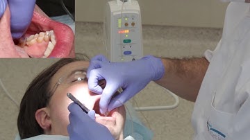 The Wand® STA Instrument -  PDA (periodontal Ligament injection) Demonstration