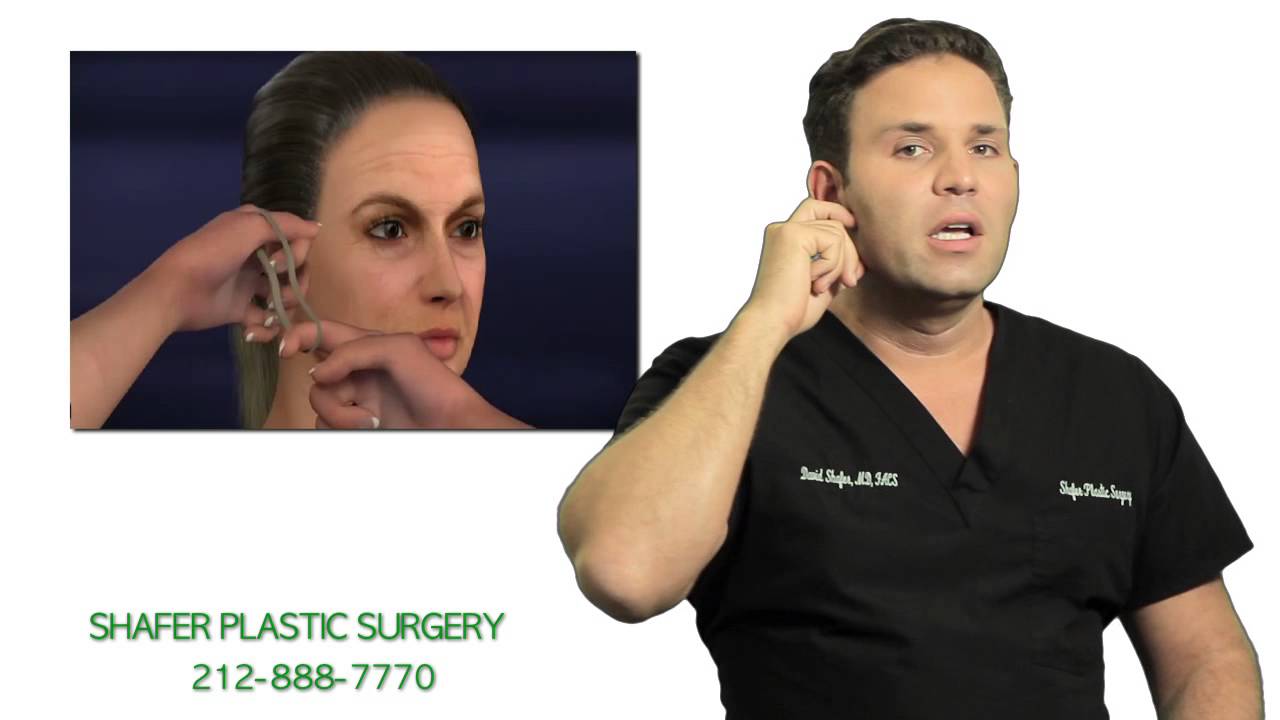 Facelift Plastic Surgery NYC Dr. David Shafer - YouTube
