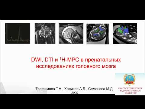 Семенова М.Д. "DWI, DTI and H-MPC в пренатальных исследованиях головного мозга"