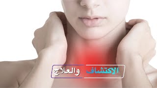 أورام الغدة الدرقية