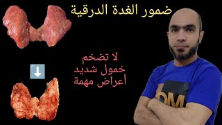 ضمور الغدة الدرقية. هام جدا بخصوص زيادة الوزن@Dr_youssef by أسرار الطب والغدد الصماء 1,468 views 4 months ago 9 minutes, 5 seconds