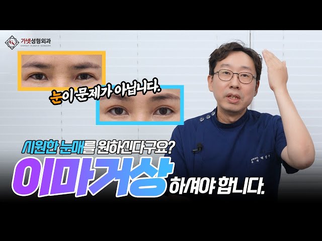 연예인처럼 크고 시원한 눈매를 만드는 방법! 트임이 아니라 이마거상으로 가능하다고?🙂