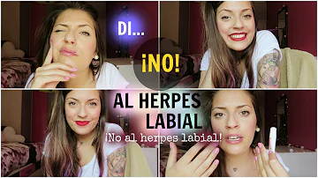 ¿Cómo disimular un herpes labial?