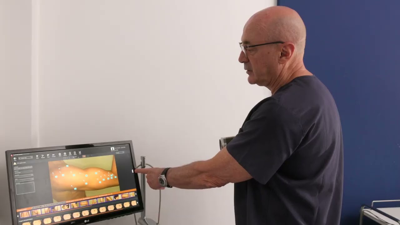 O Que é Dermatoscopia -  Saúde da Pele Com Dr. Tovo Luis Fernando