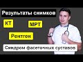 Синдром фасеточных суставов (фасеточный синдром, спондилёз, спондилоартроз)