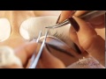 Individual Eyelash Extensions by Lucy Vo