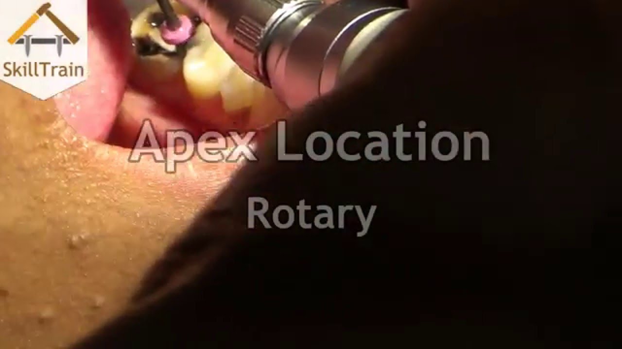 Apex Location Rotary (Marathi) (मराठी) YouTube