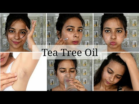  Realistic Ways To Use Tea Tree Oil || Remove Acne,  Marks, Blemishes ,