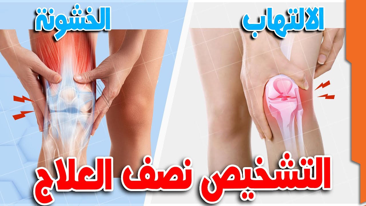 الم المفاصل | الفرق بين التهاب المفصل وخشونة المفصل