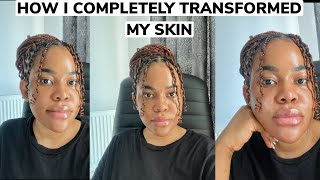 7 THINGS I DID THAT DRASTICALLY IMPROVED MY SKIN FOR A YOUTHFUL AND RADIANT SKIN. Practical tips