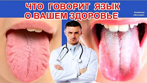 ЭТИ  СТРАННЫЕ ВЕЩИ  НА  ЯЗЫКЕ , ПОДСКАЖУТ  ВАМ О ПРОБЛЕМЕ С ВАШИМ ЗДОРОВЬЕМ