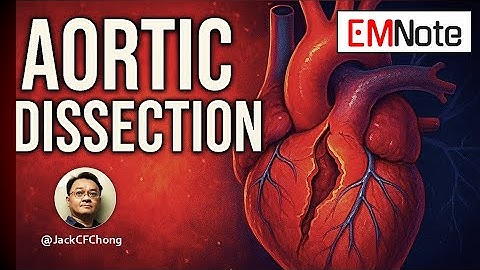 Aortic Dissection Misdiagnosis
