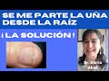 "SE ME PARTE LA UÑA DESDE LA RAÍZ" 😱LA SOLUCIÓN 👍