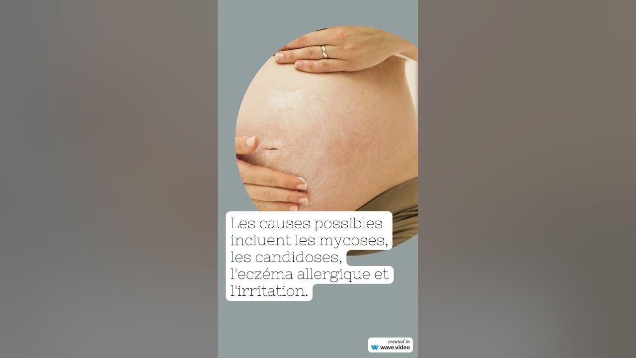 ROUGEUR AISSELLE rougeurs et boutons rouges sous les aisselles YouTube
