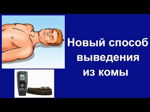 Необычный но эффективный способ выведения из комы Что делать если человек потерял сознание