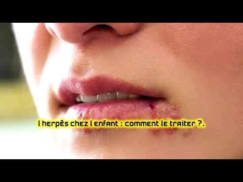 L’herpès chez l’enfant : comment le traiter ? - YouTube