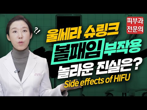   Eng 울쎄라 슈링크 더블로 리프팅 부작용 볼패임 받아도 될까 Side Effects Of HIFU 피부과전문의 닥터필러