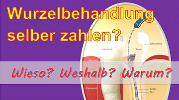 Wann wird eine Wurzelbehandlung von der Kasse bezahlt?