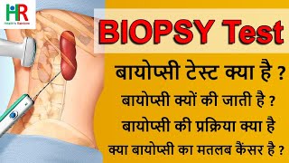 what is biopsy test in hindi ?  Why biopsy is done ? Biopsy procedure ? बायोप्सी क्यों की जाती है? screenshot 2