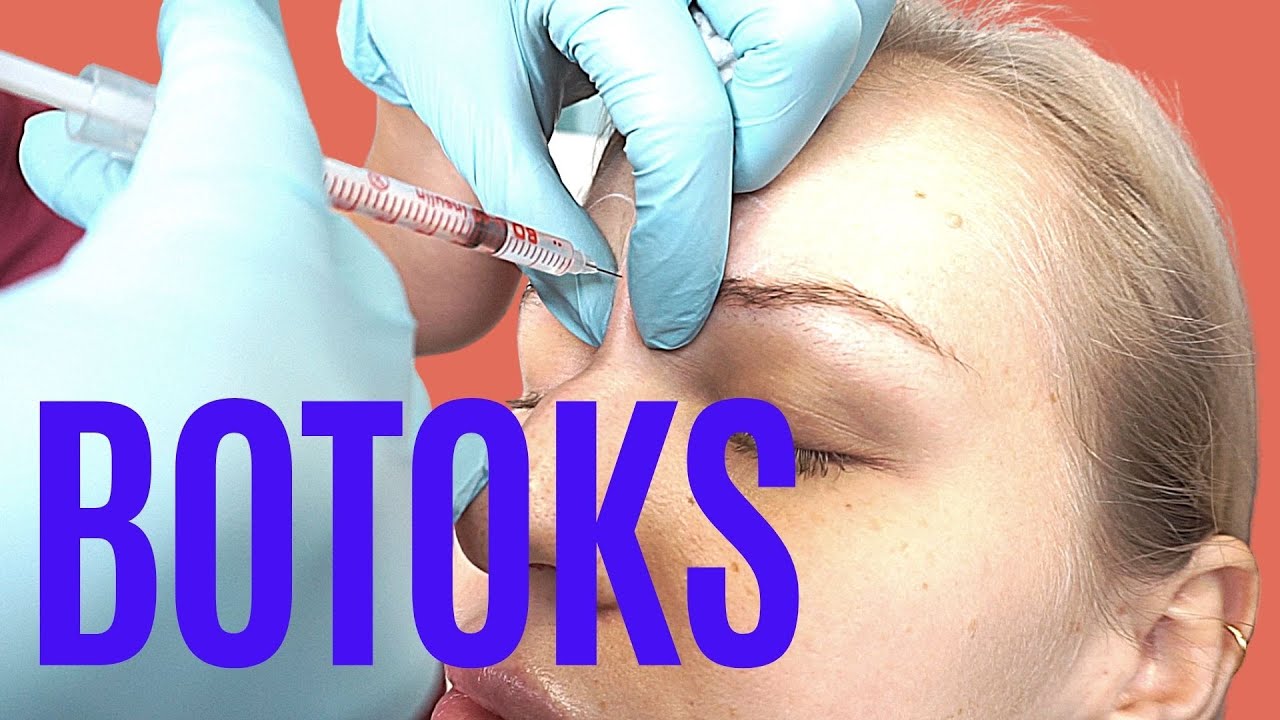 Lwia zmarszczka jak się pozbyć? Botoks vs. Kwas hialuronowy [ZOBACZ ...