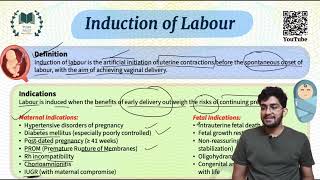 Induction of labour - Easy notes and explanation