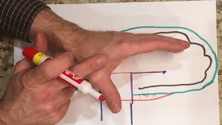 How to make a pattern for a Resting Pan Orthosis (Volar Wrist Hand Finger Orthosis)