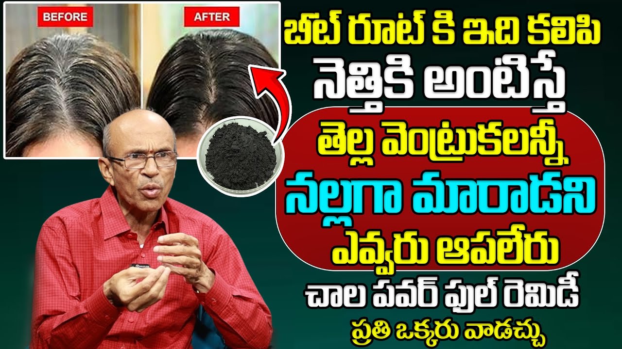 తెల్ల వెంట్రుకలన్నీ నల్లగా మారాడని ఎవ్వరు ఆపలేరు.. | White Hair Probelm | @ManamtvDoctorsOfficial