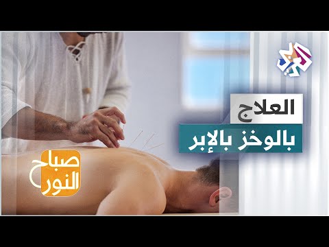 كيف يساعد الوخز بالإبر على علاج متلازمة الألم العضلي الليفي؟