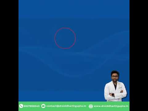 Bipolar Hemiarthroplasty in