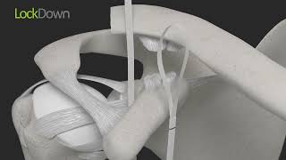 LockDown ACJ Animation