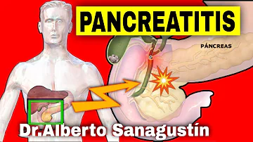 ¿Cómo puedo saber si mi pancreatitis es aguda o crónica?