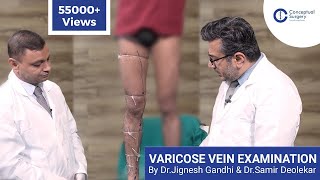 Varicose Vein Examination Dr. Jignesh Gandhi and Dr. Samir Deolekar