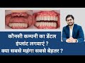     implant     which dental implant companies are best by seraphic dental