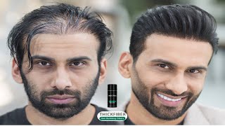 Thinning Haircut (Hair Style for Men) No Hair Toppers, No wigs or Hair Replacement I 2023