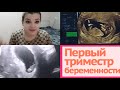 ПЕРВЫЙ ТРИМЕСТР БЕРЕМЕННОСТИ || ПЕРВЫЙ скрининг || когда вставать на учёт??! || таксикоз 🤢