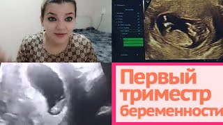 ПЕРВЫЙ ТРИМЕСТР БЕРЕМЕННОСТИ || ПЕРВЫЙ скрининг || когда вставать на учёт??! || таксикоз 🤢