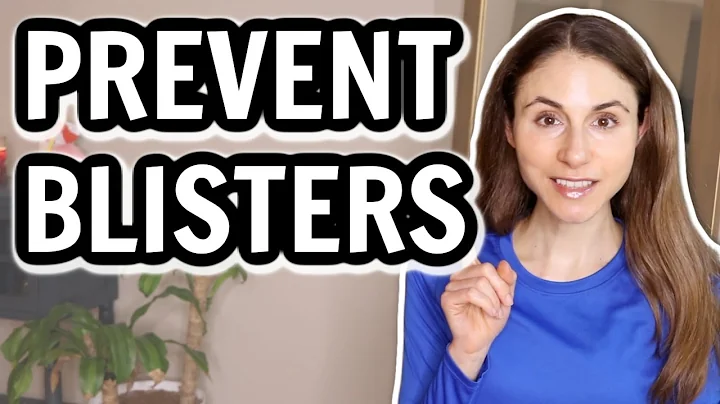 PREVENT AND TREAT BLISTERS THE RIGHT WAY 👣 DERMATOLOGIST @DrDrayzday