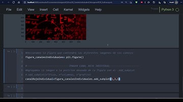 22 Varias Gráficas en un sola Figura (Parte01) | Procesamiento de Imágenes con Python