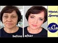 معجزة تجميلية يقدمها أشهر طبيب تجميل شد ورفع الخدود المترهلة شد الوجه والرقبة وملئ الخطوط والتجاعيد معجزة تجميلية يقدمها أشهر طبيب تجميل شد ورفع الخدود المترهلة شد الوجه والرقبة وملئ الخطوط والتجاعيد