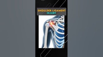 कंधे में दर्द | Shoulder Pain | Shoulder Ligament Injury