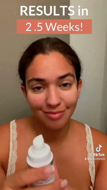 best-acne-dark-spot-treatment-products-top-routine-for-sensitive