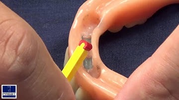 How to Change A Hader Clip